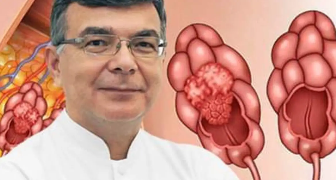 Detectarea timpurie a cancerului de sân: Sfaturi esențiale de la Prof. Dr. Alexandru Blidaru